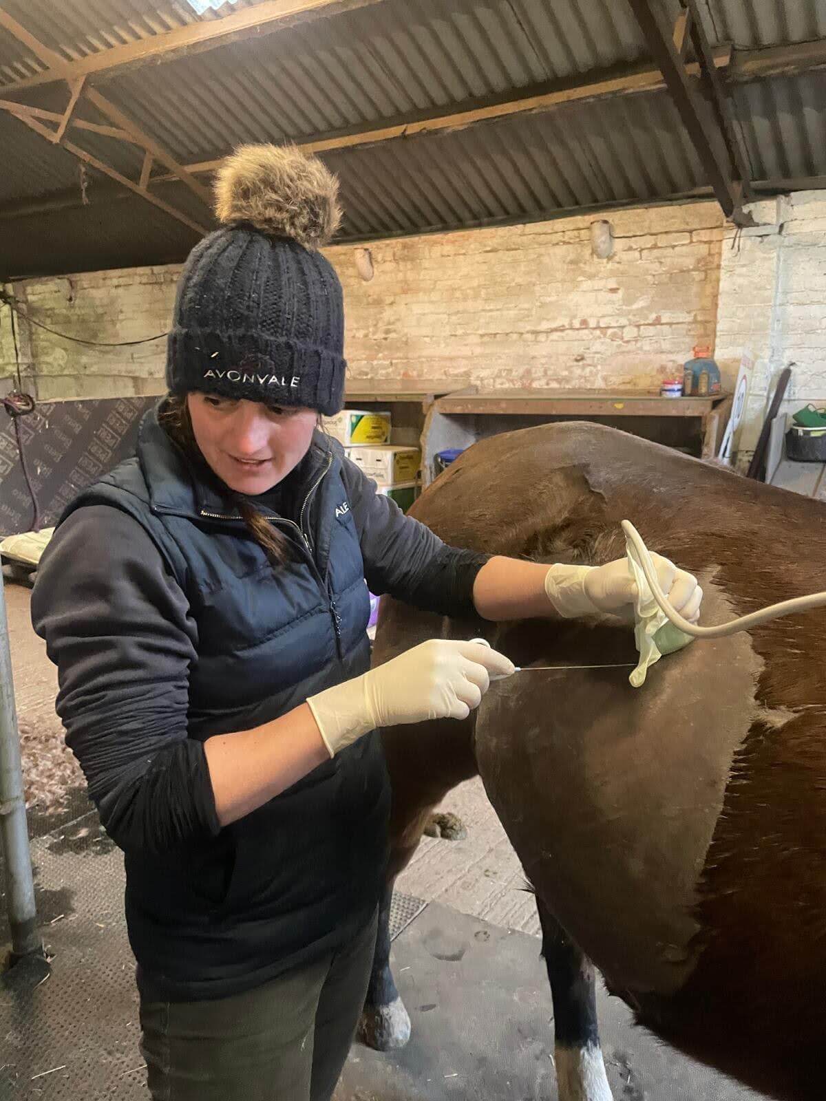 Liver disease biopsy