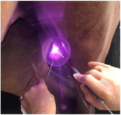 Sarcoid Laser Treatment