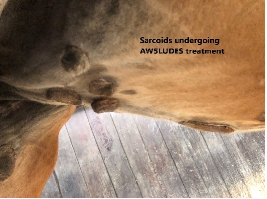 Sarcoids_Undergoing_AW5LUDES_Treatment