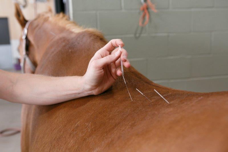What is Acupuncture?